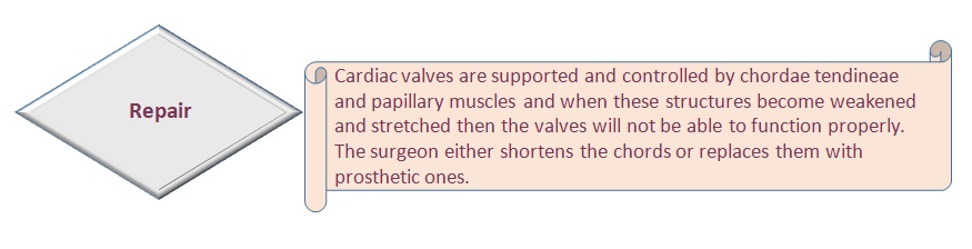 Cardiac valve repair surgery5